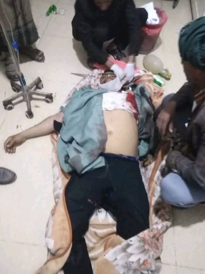 مقتل شخص وإصابة اثنين في حادثين منفصلين بإب وذمار